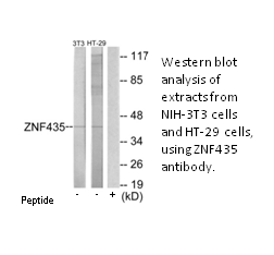Product image for ZNF435 Antibody