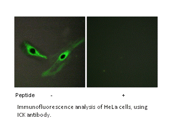 Product image for ICK Antibody