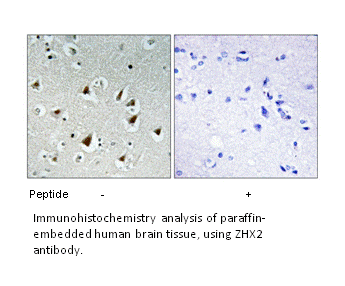 Product image for ZHX2 Antibody