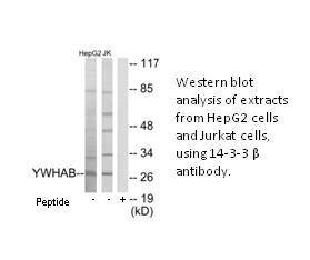 Product image for 14-3-3 &beta; Antibody