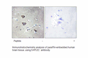 Product image for 5-HT-2C Antibody