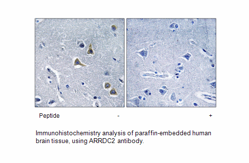 Product image for ARRDC2 Antibody