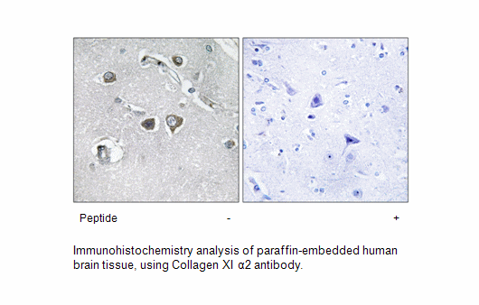Product image for Collagen XI &alpha;2 Antibody