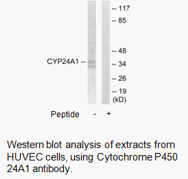 Product image for Cytochrome P450 24A1 Antibody