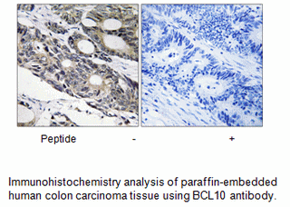 Product image for BCL10 Antibody
