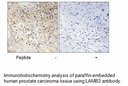 Product image for LAMB3 Antibody