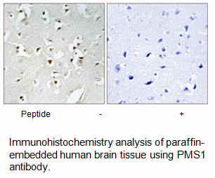Product image for PMS1 Antibody