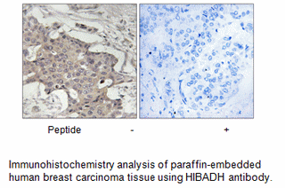 Product image for HIBADH Antibody