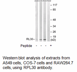 Product image for RPL30 Antibody