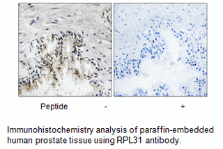 Product image for RPL31 Antibody