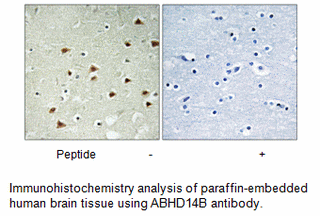 Product image for ABHD14B Antibody
