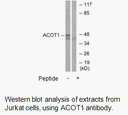 Product image for ACOT1 Antibody