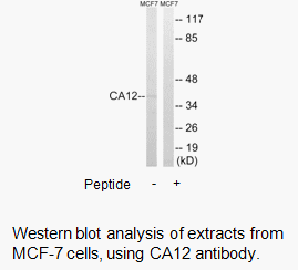 Product image for CA12 Antibody