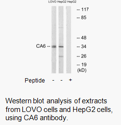 Product image for CA6 Antibody