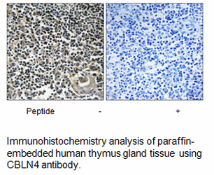 Product image for CBLN4 Antibody