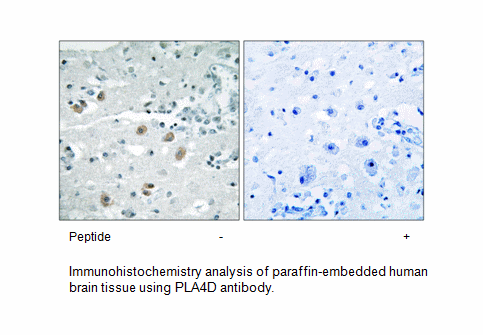 Product image for PLA2G4D Antibody