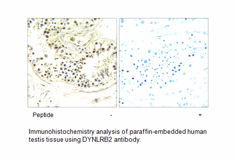 Product image for DYNLRB2 Antibody