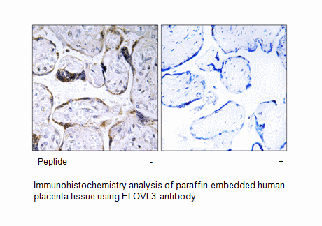 Product image for ELOVL3 Antibody