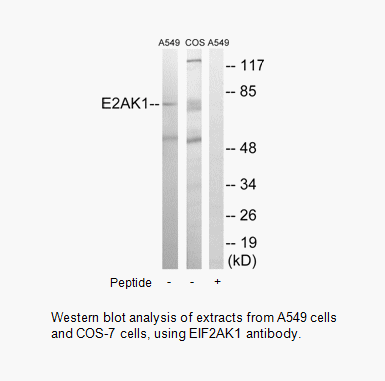 Product image for EIF2AK1 Antibody