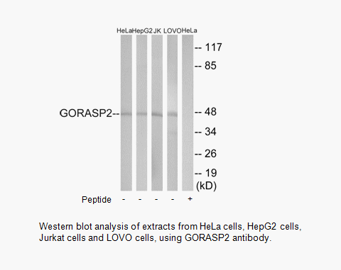 Product image for GORASP2 Antibody