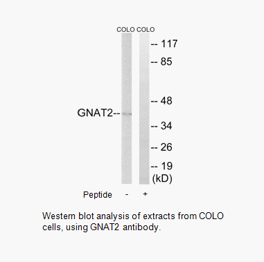 Product image for GNAT2 Antibody