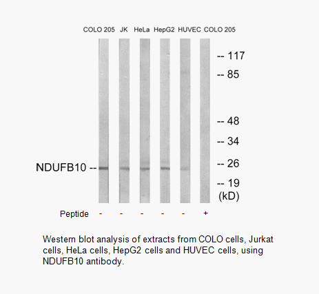 Product image for NDUFB10 Antibody