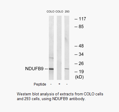 Product image for NDUFB9 Antibody