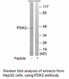 Product image for PDK2 Antibody