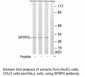 Product image for SFRP2 Antibody
