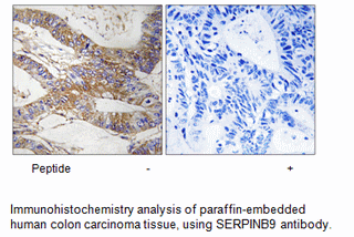 Product image for SERPINB9 Antibody