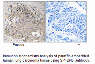 Product image for SPTBN5 Antibody