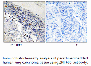 Product image for ZNF600 Antibody