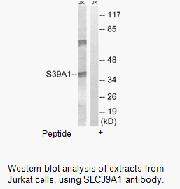 Product image for SLC39A1 Antibody
