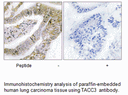 Product image for TACC3 Antibody