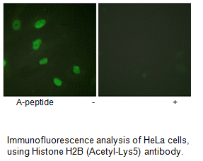 Product image for Histone H2B (Acetyl-Lys5) Antibody