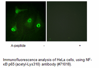 Product image for NF-&kappa;B p65 (Acetyl-Lys310) Antibody
