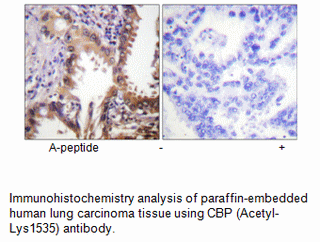 Product image for CBP (Acetyl-Lys1535) Antibody