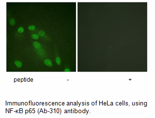Product image for NF-&kappa;B p65 (Ab-310) Antibody