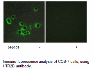 Product image for HTR2B Antibody
