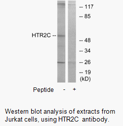Product image for HTR2C Antibody