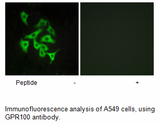 Product image for GPR100 Antibody