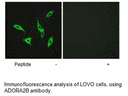 Product image for ADORA2B Antibody