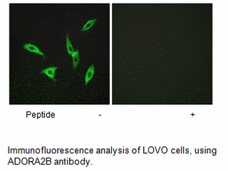 Product image for ADORA2B Antibody