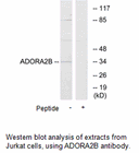 Product image for ADORA2B Antibody