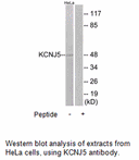 Product image for KCNJ5 Antibody