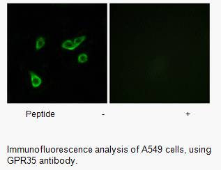 Product image for GPR35 Antibody