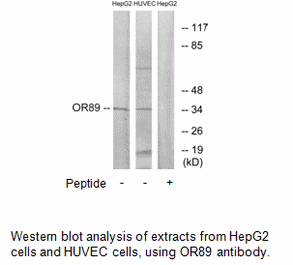 Product image for OR89 Antibody