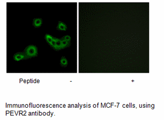 Product image for PEVR2 Antibody