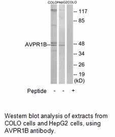 Product image for AVPR1B Antibody
