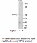 Product image for VIPR2 Antibody